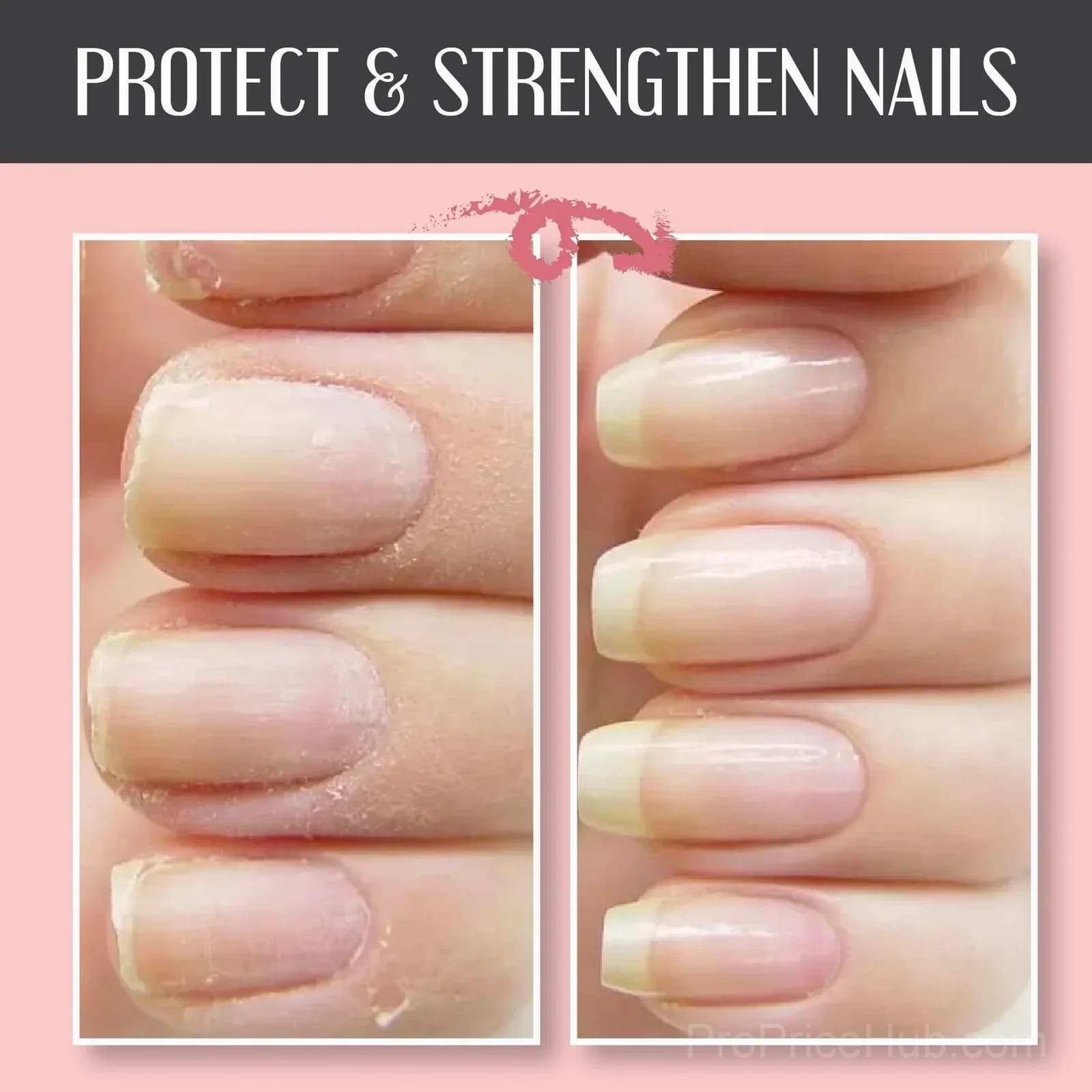 Nail Repair and Protection Gel - View 4