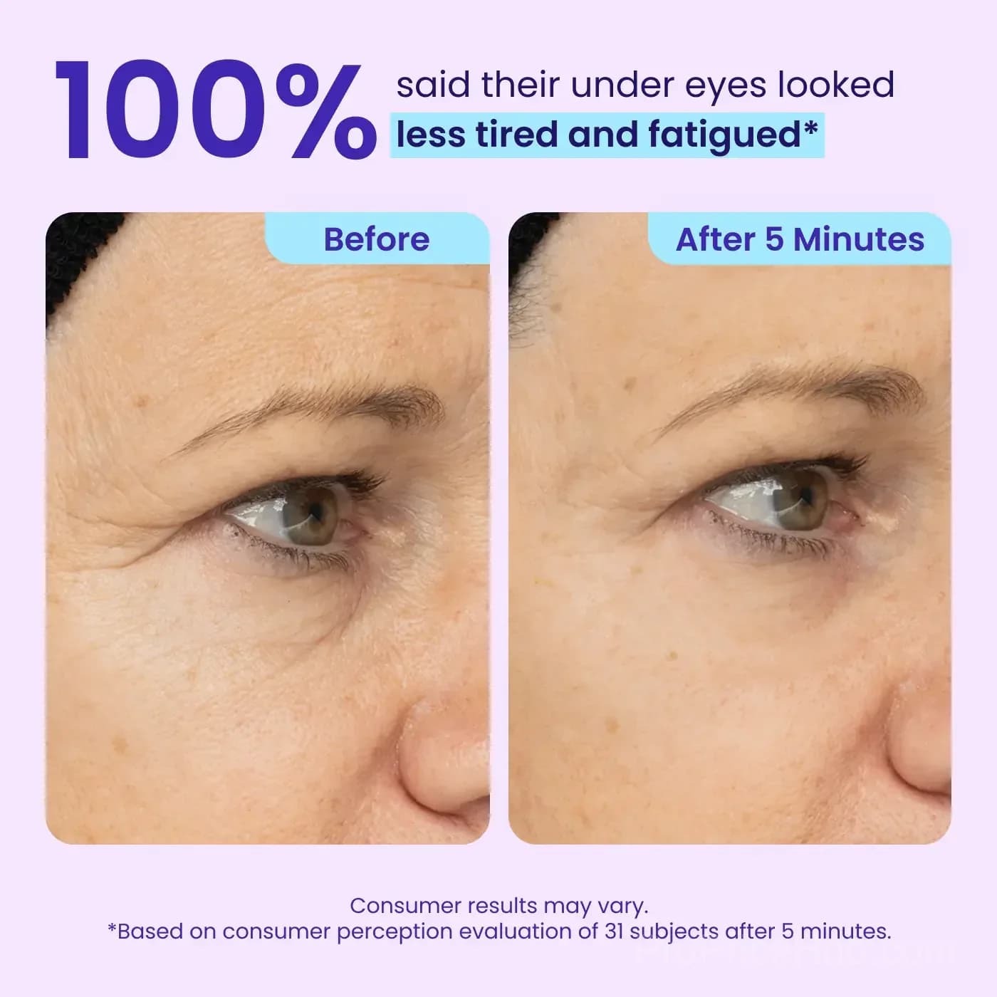 Eye Bag Instant Eraser - Under-Eye Face Care Treatment - View 5