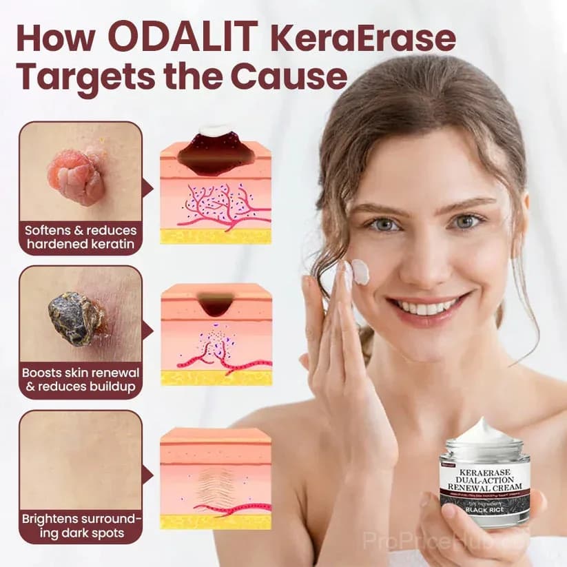KeraErase Dual-Action Renewal Cream - Alt