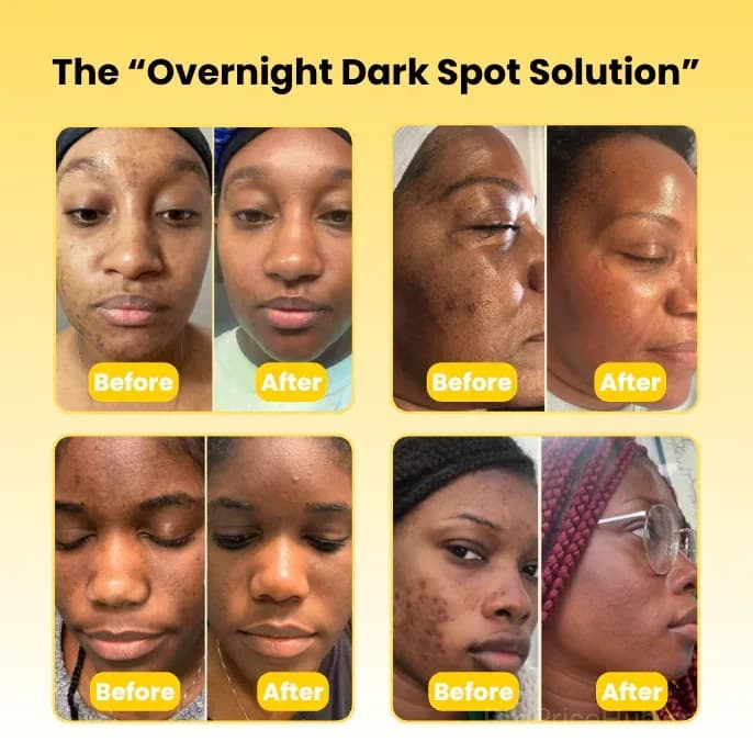 Kojic Acid & Turmeric Overnight Face Mask - Alt
