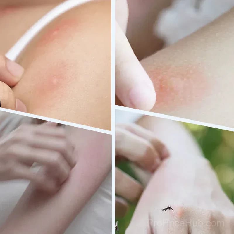 2026 Ultrasonic Mosquito Repellent Bracelet, Non-Toxic - Alt