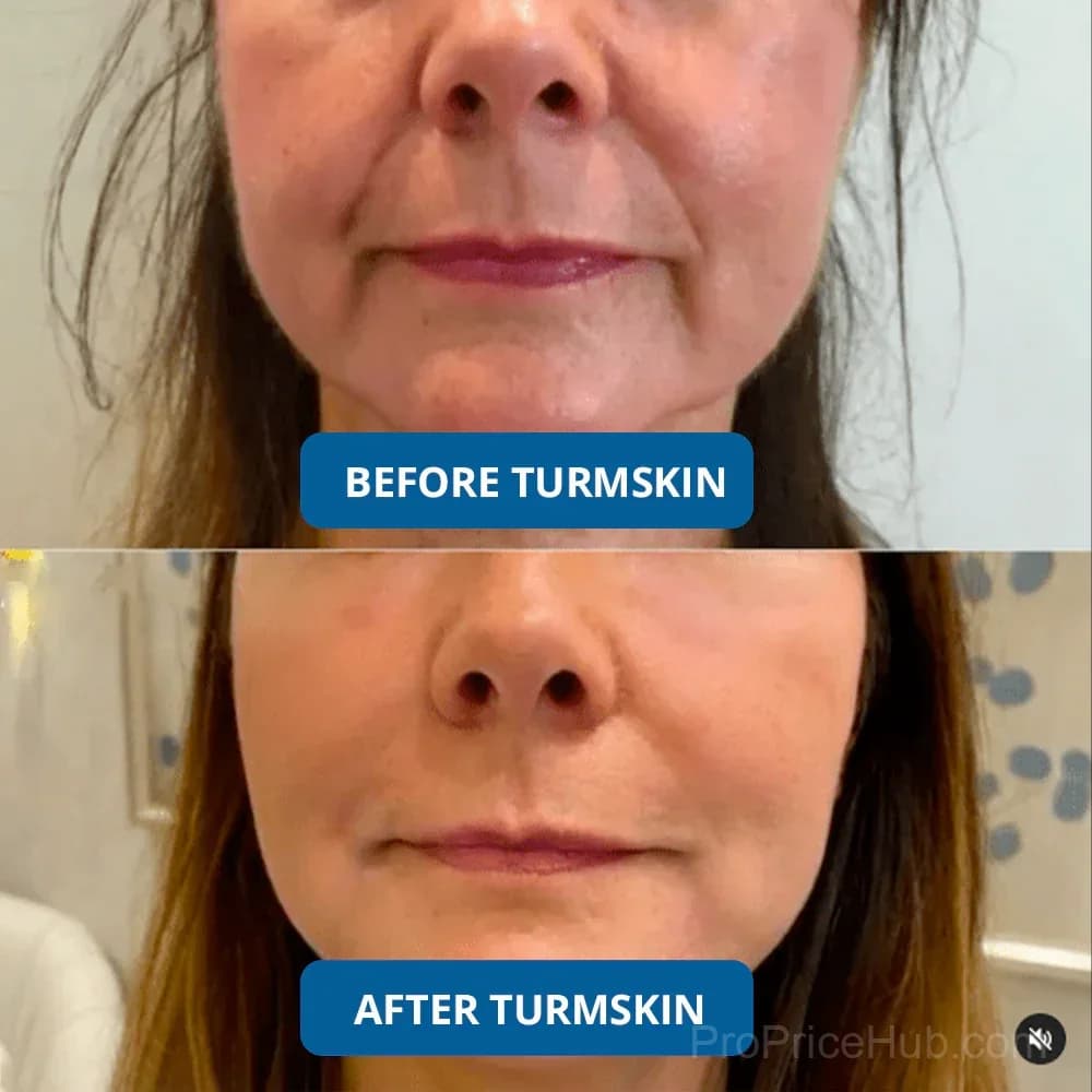 3% Hyaluronic Acid Ultra Hydrating Serum - View 4