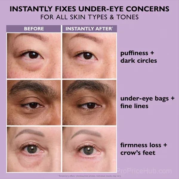 Eye Bag Instant Eraser - Under-Eye Face Care Treatment - Alt