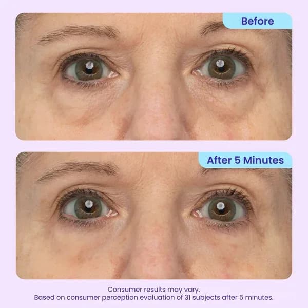 Eye Bag Instant Eraser - Under-Eye Face Care Treatment - View 3