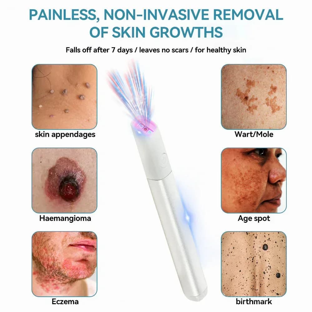 All-in-One CO₂ Laser Eraser Pen for Moles, Warts & Skin Flaws - Alt