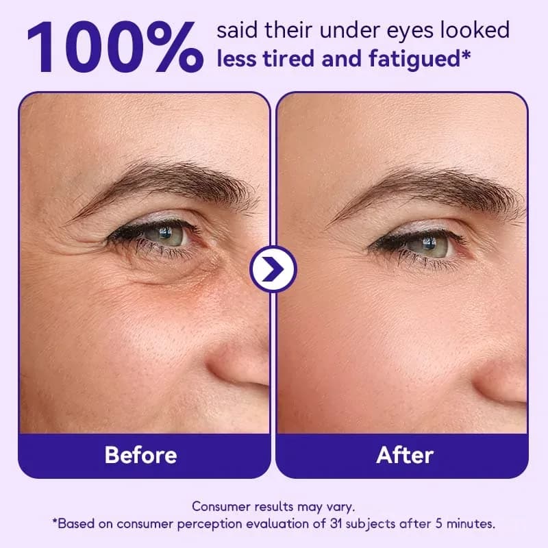 Instant Lift Eye Gel for Bags and Puffiness - Alt