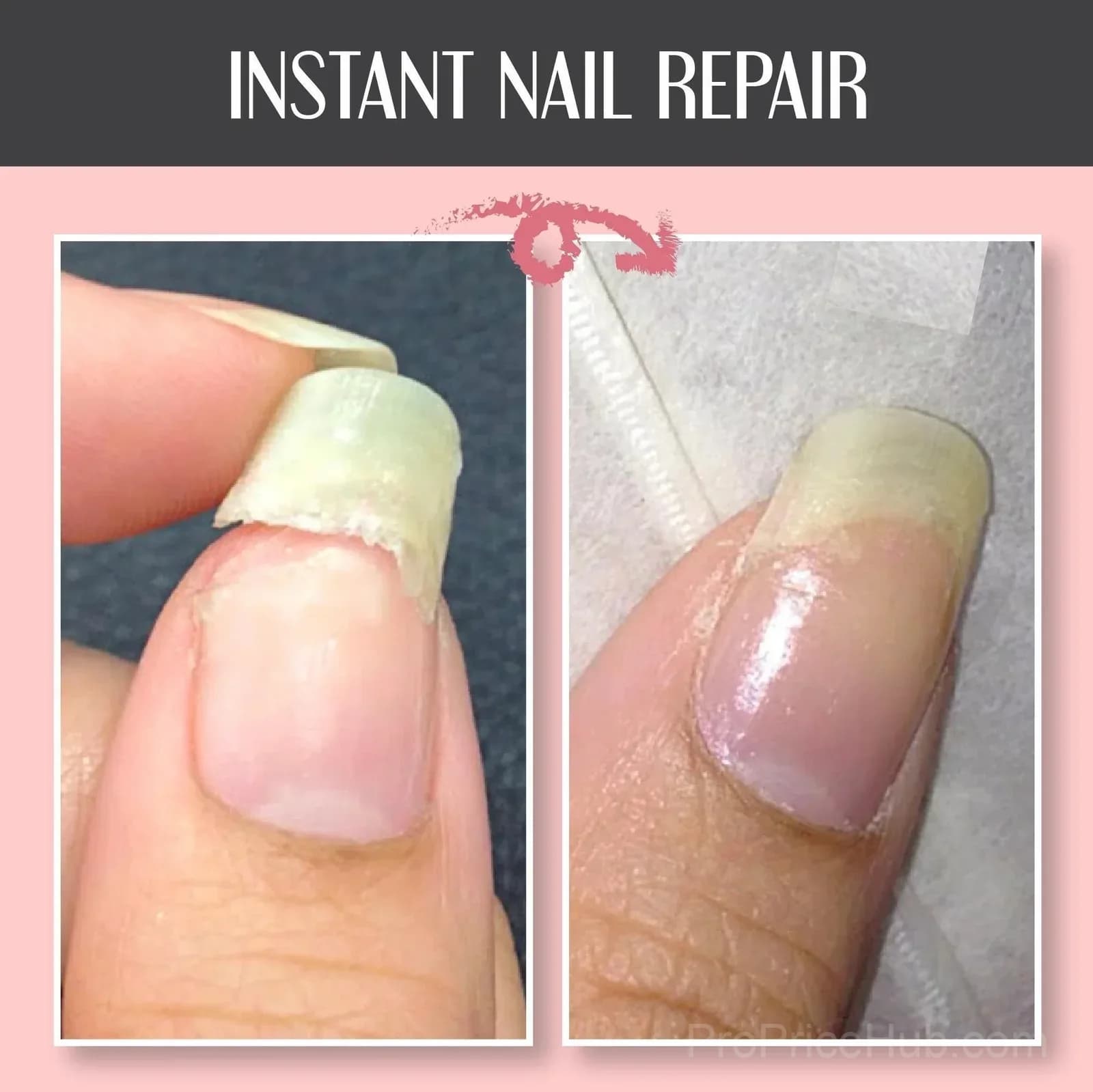 Nail Repair and Protection Gel - View 3