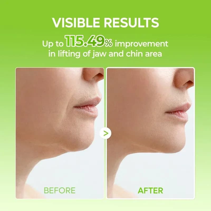 V-Lifting Mewing Band (4 Masks Per Pack) - View 6