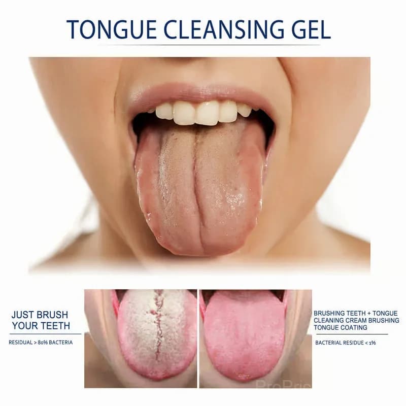 Probiotic Tongue Cleaning Gel & Scraper Set - View 5