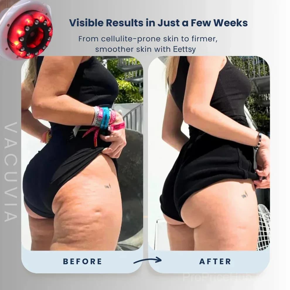 Eettsy Skin Firming & Toning Cream - View 3