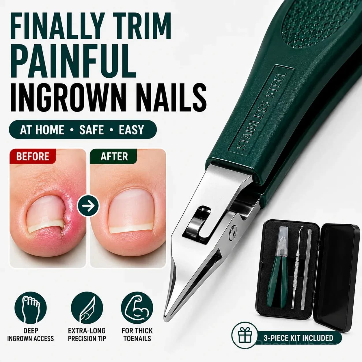 Eagle Beak Beveled Nail Clippers – 3-Piece Grooming Kit - Main