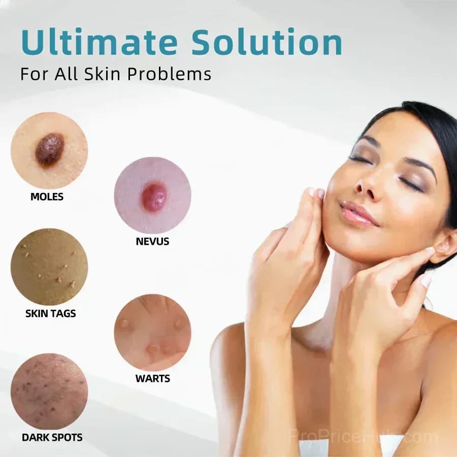 All-in-One CO₂ Laser Eraser Pen for Moles, Warts & Skin Flaws - View 8