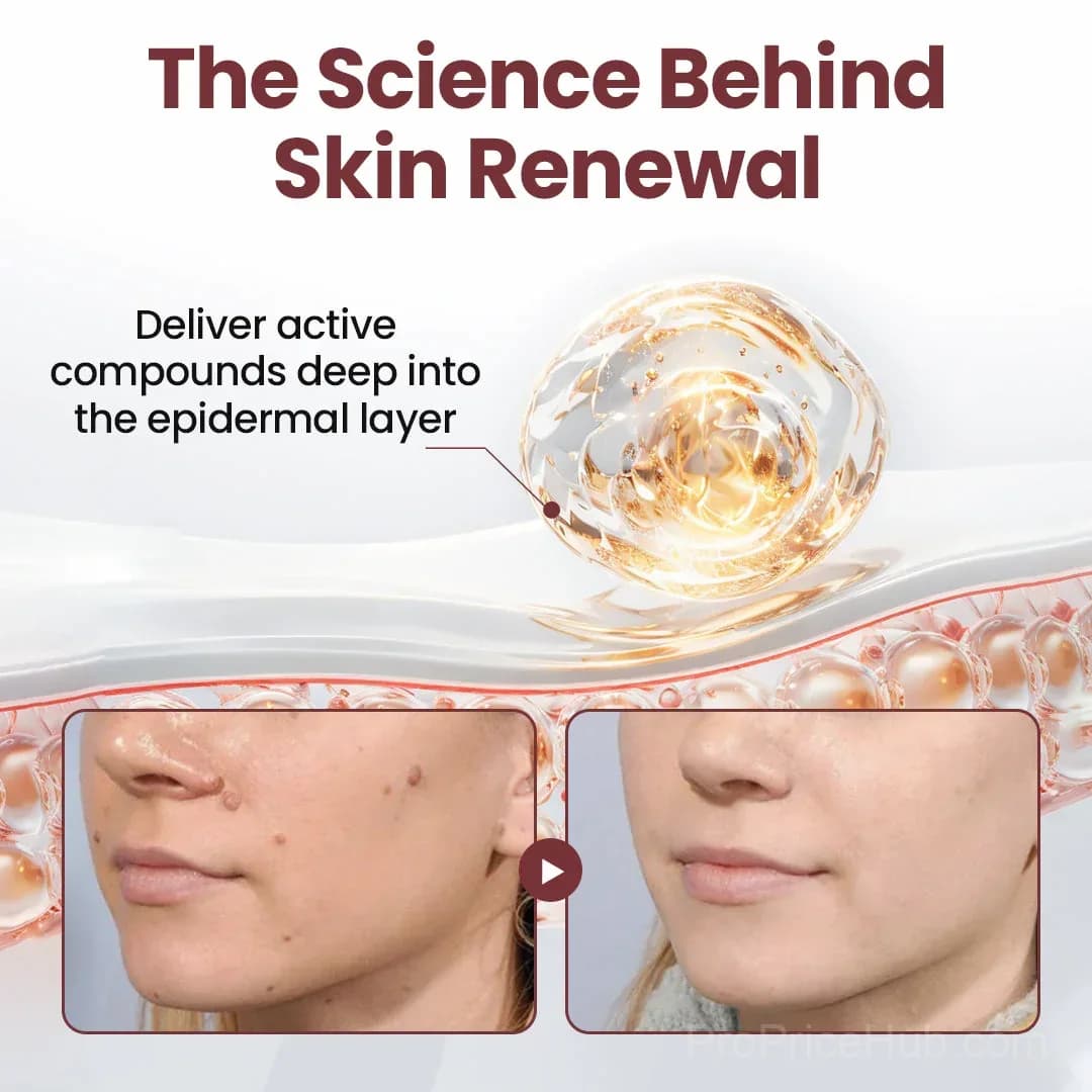 KeraErase Dual-Action Renewal Cream - View 4