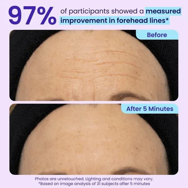 Eye Bag Instant Eraser - Under-Eye Face Care Treatment - View 4