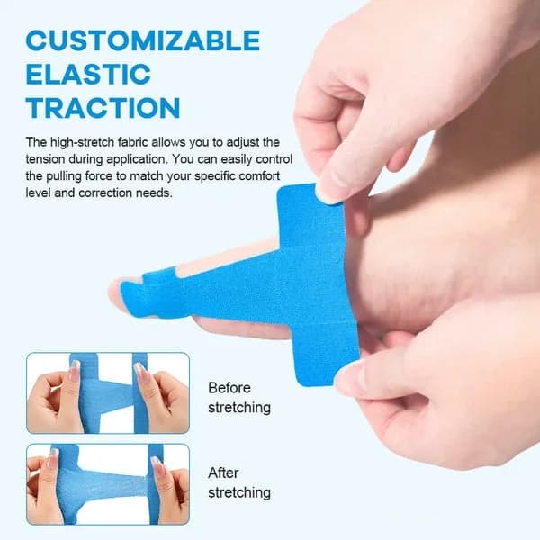 Pre-cut Bunion Corrector Kinesiology Tape - Alt