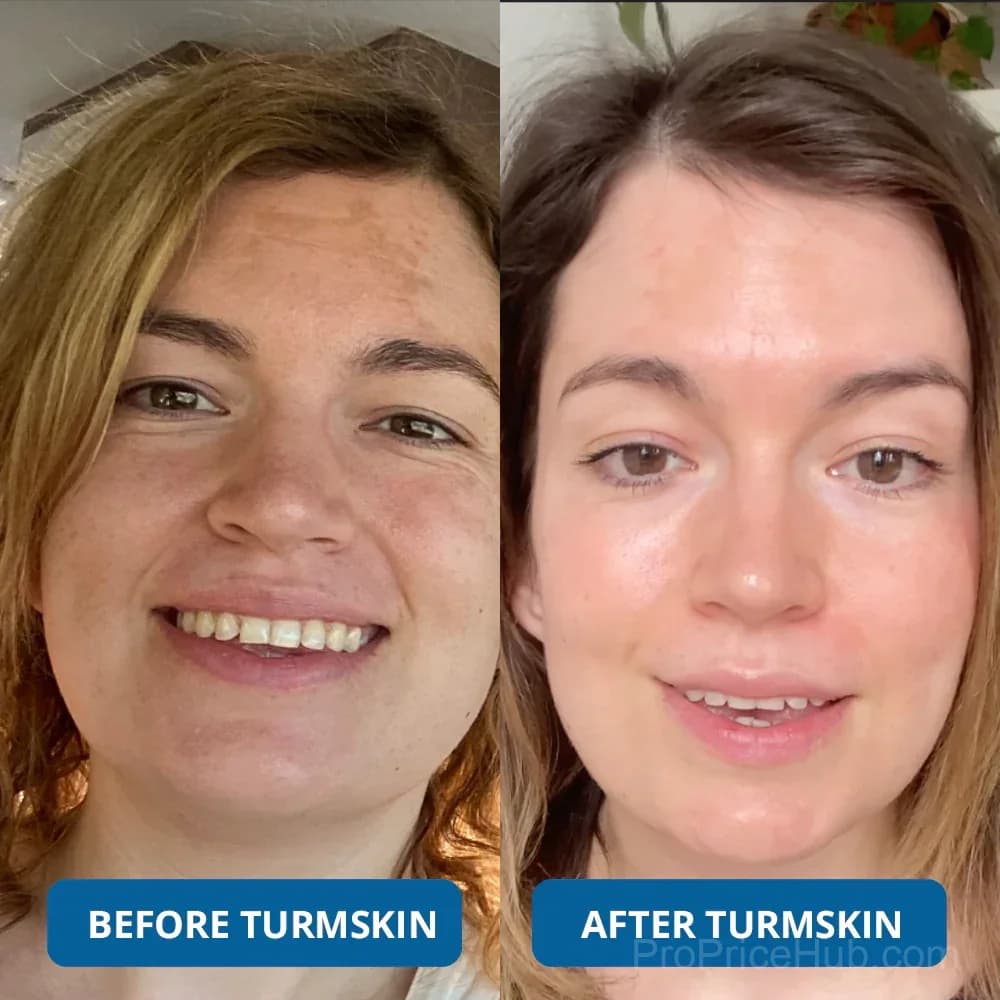 3% Hyaluronic Acid Ultra Hydrating Serum - View 3
