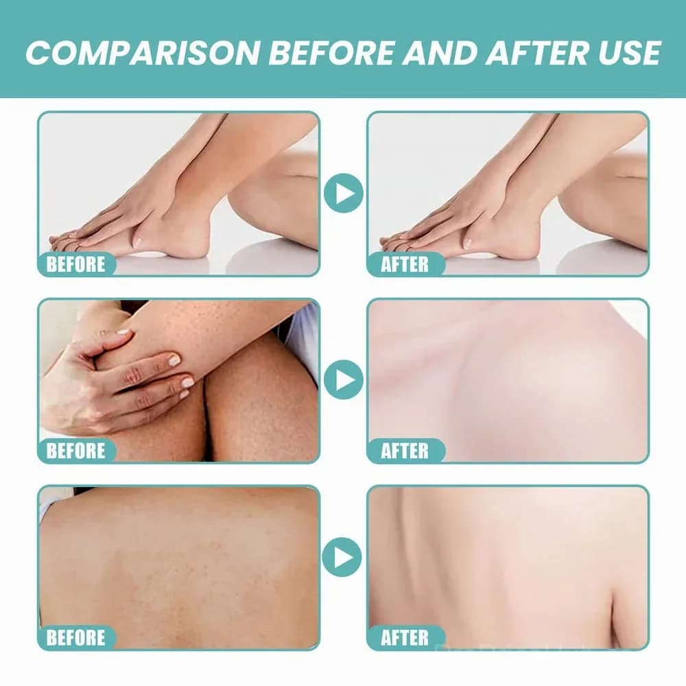 Skin So Soft Original Bath Oil for Silky Smooth Skin - View 5