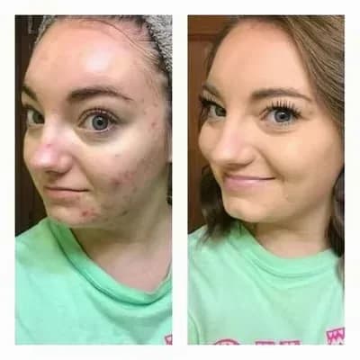 Tricolor Concealer with 3 Shades - View 10