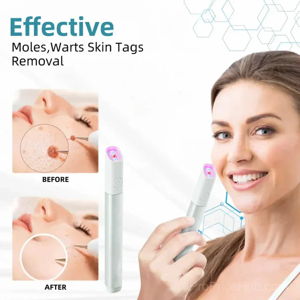 All-in-One CO₂ Laser Eraser Pen for Moles, Warts & Skin Flaws - View 7