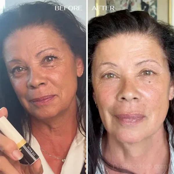 All-in-One Under-Eye Balm - Alt