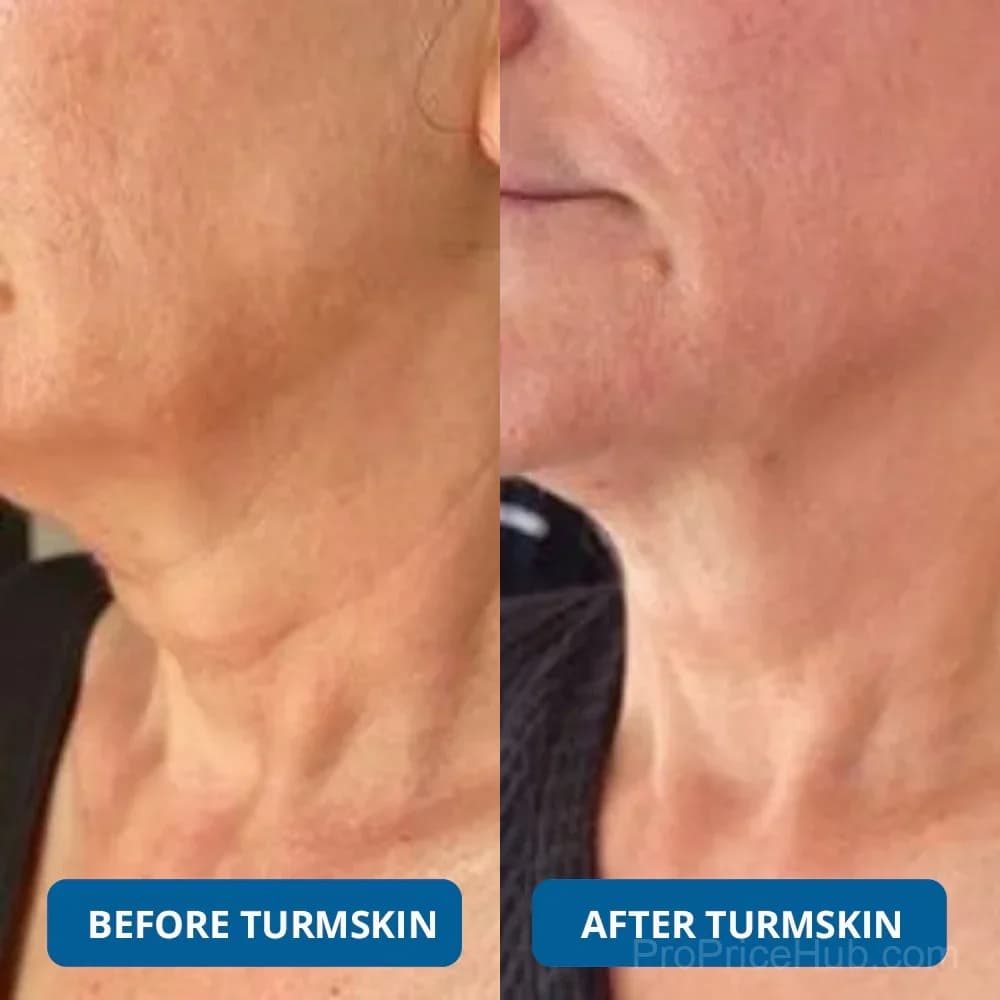 3% Hyaluronic Acid Ultra Hydrating Serum - View 5