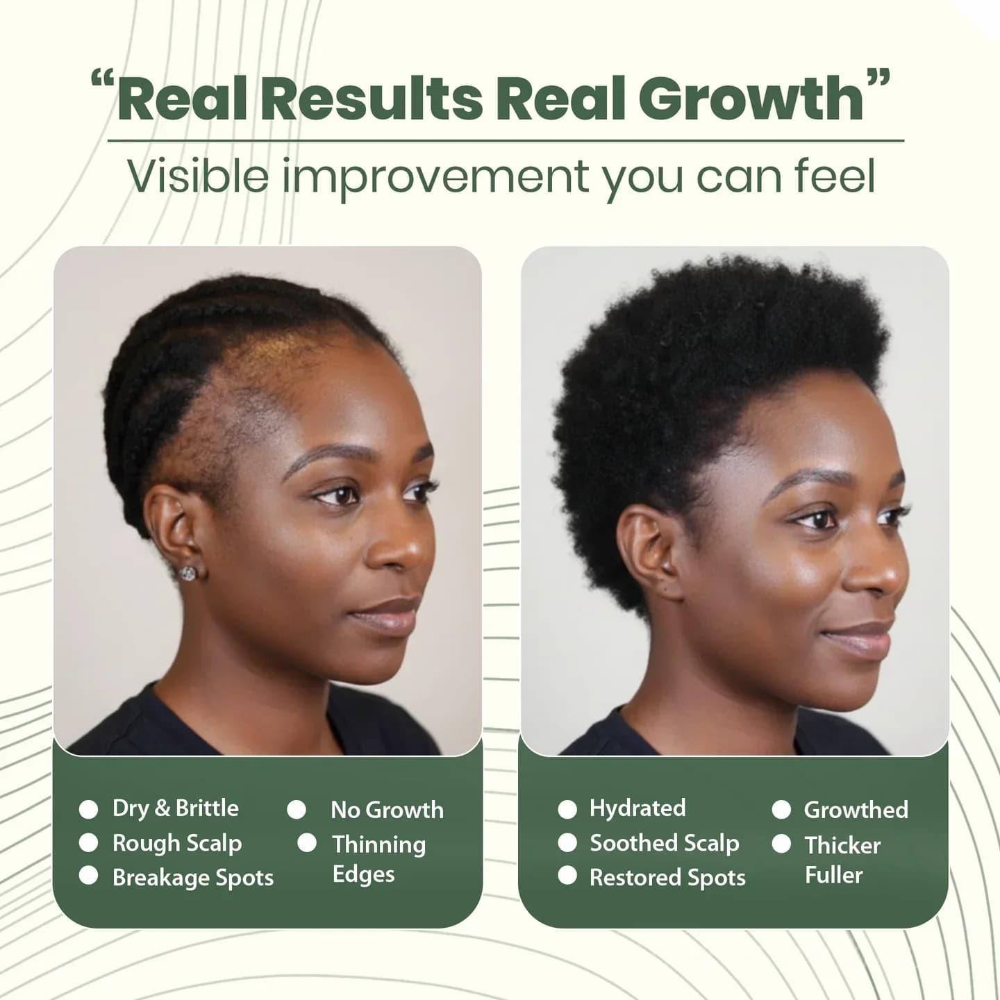 Batana Natural Hair Growth Oil - Scalp Treatment - Alt