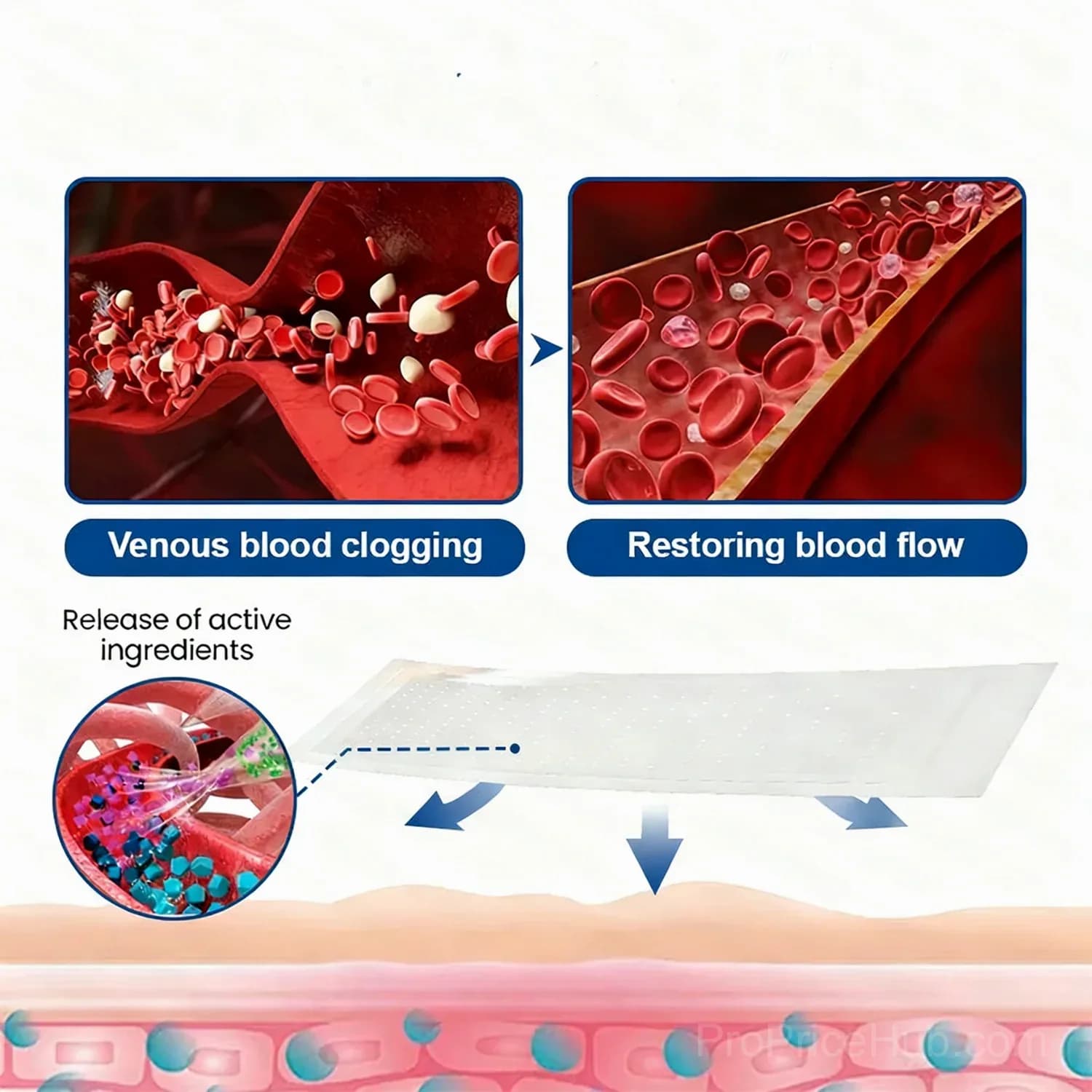 Vein Contour Microneedle Patch with Diosmin & Hesperidin, 7-Day - View 9