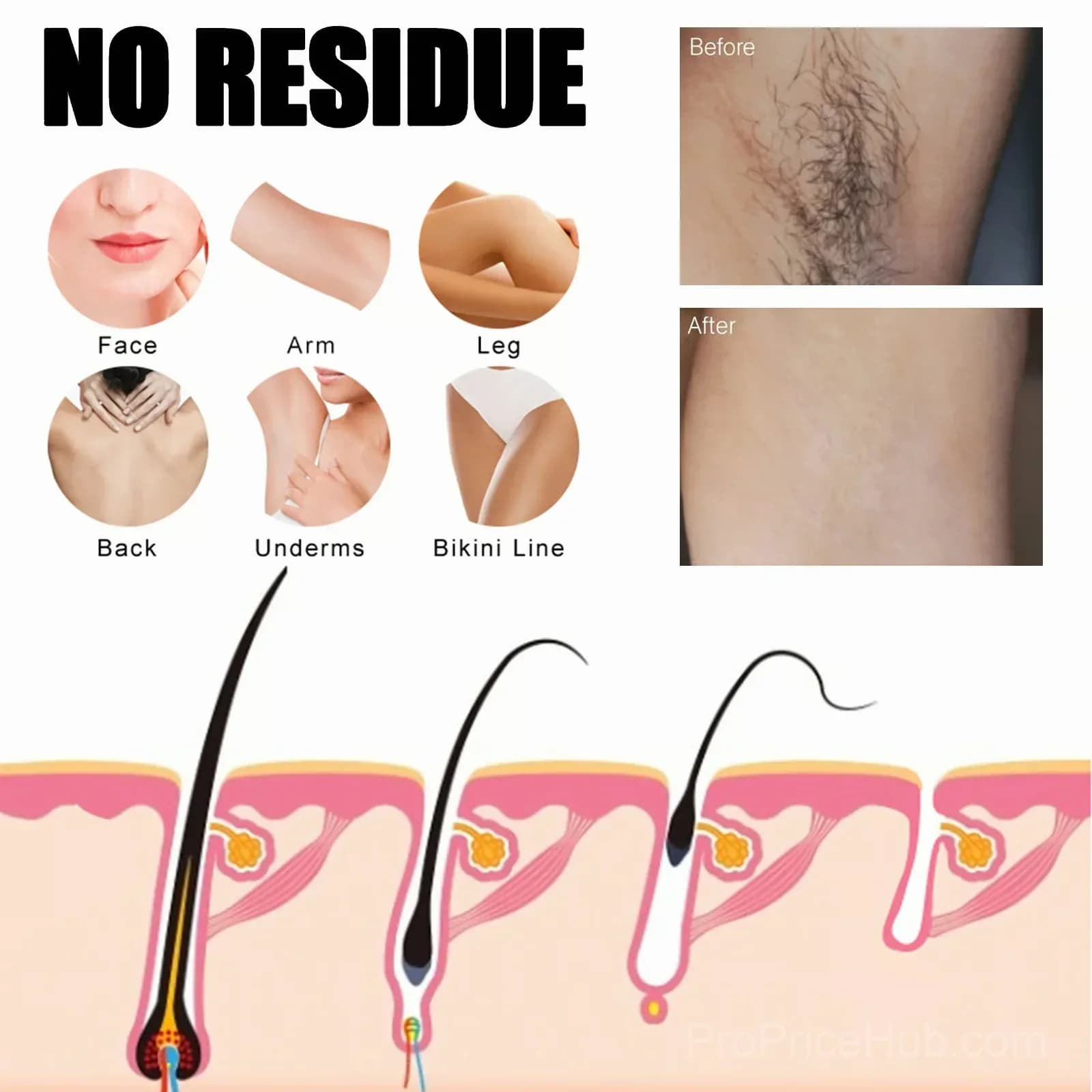 Body Hair Removal Spray for Women - View 8