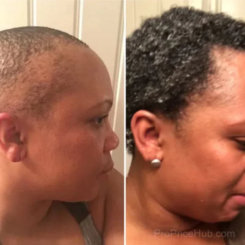 OUR+ Hair Revival Ampoule Treatment, 1.5 oz - View 10