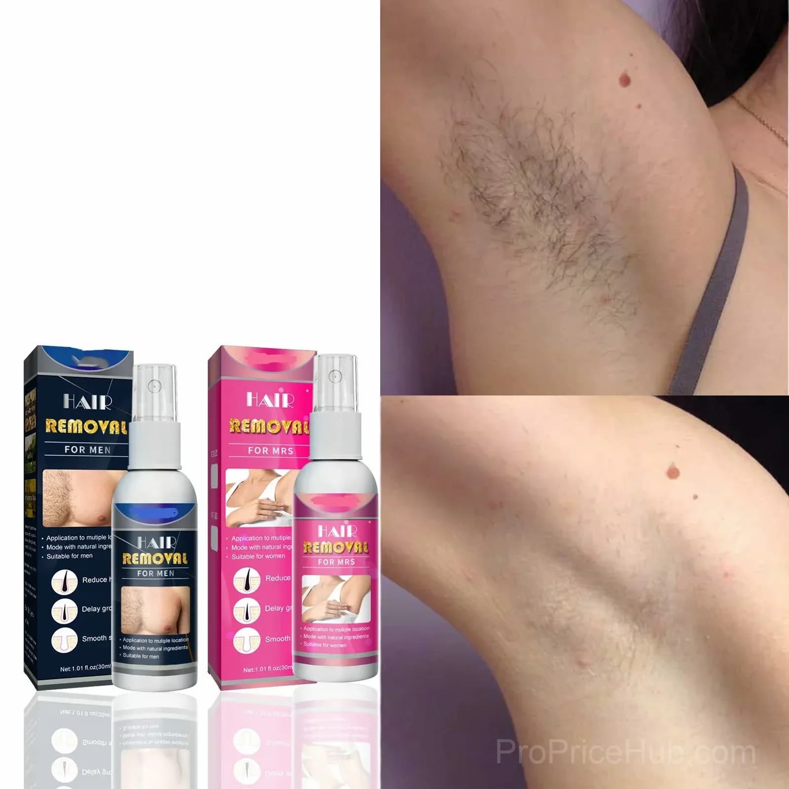 Body Hair Removal Spray for Women - View 5