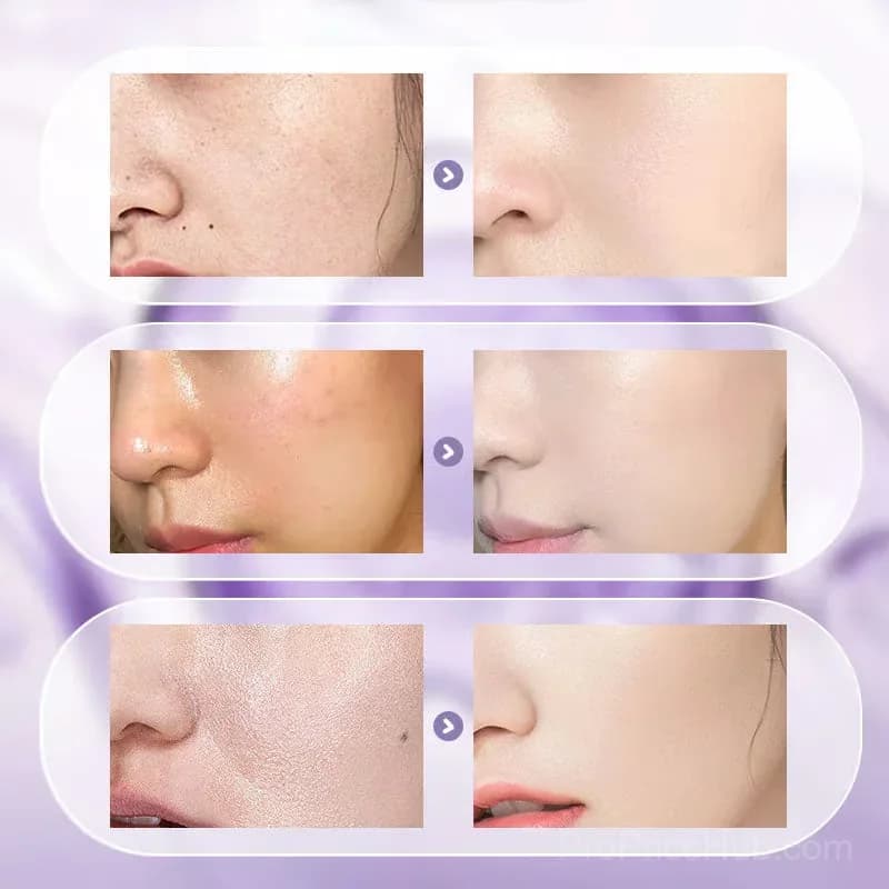 All-in-One Niacinamide Face Cream, 100g - View 8
