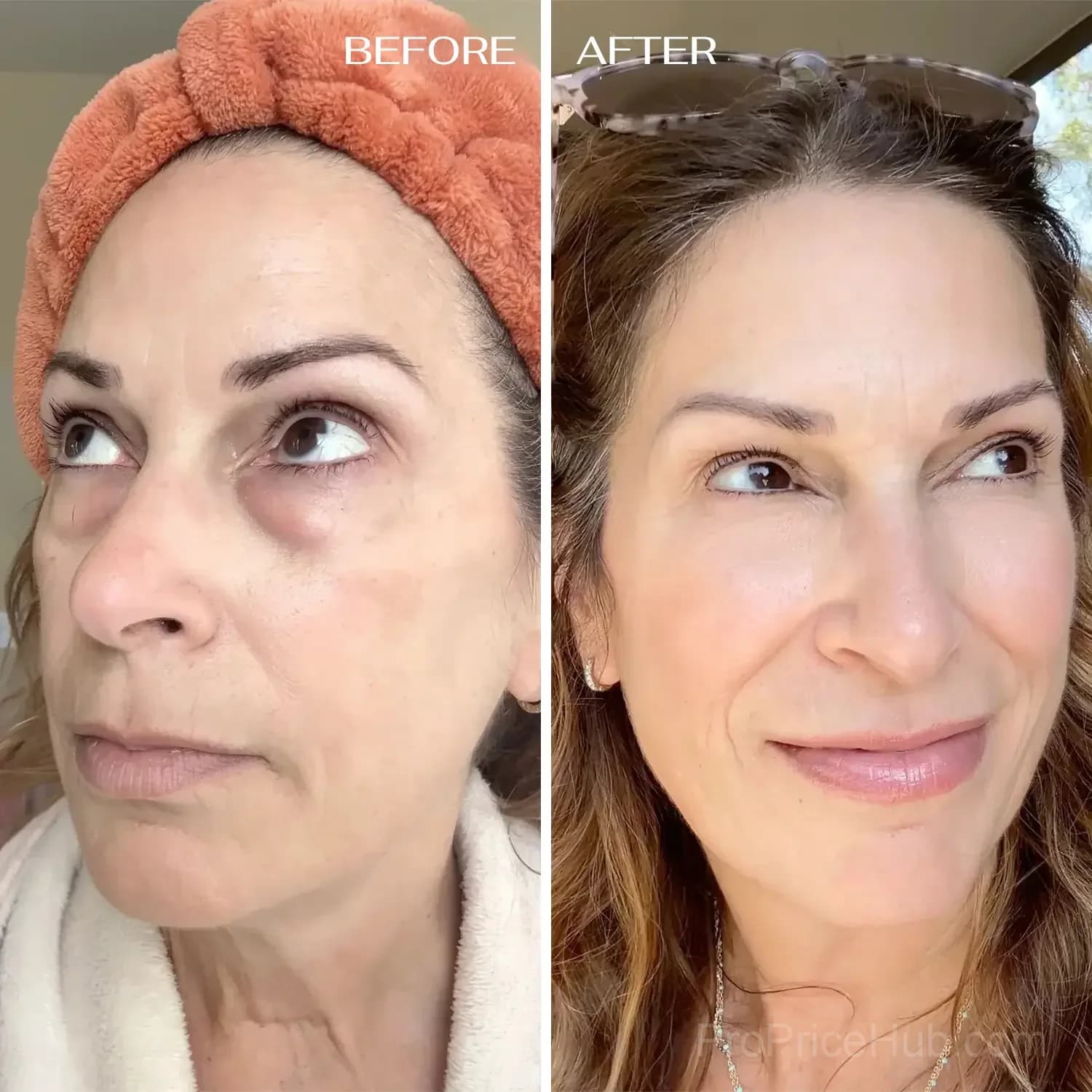 All-in-One Under-Eye Balm - View 8