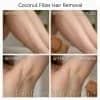 Coconut Hair Removal Cream for Face, Underarms, Legs & Intimate Areas - View 10