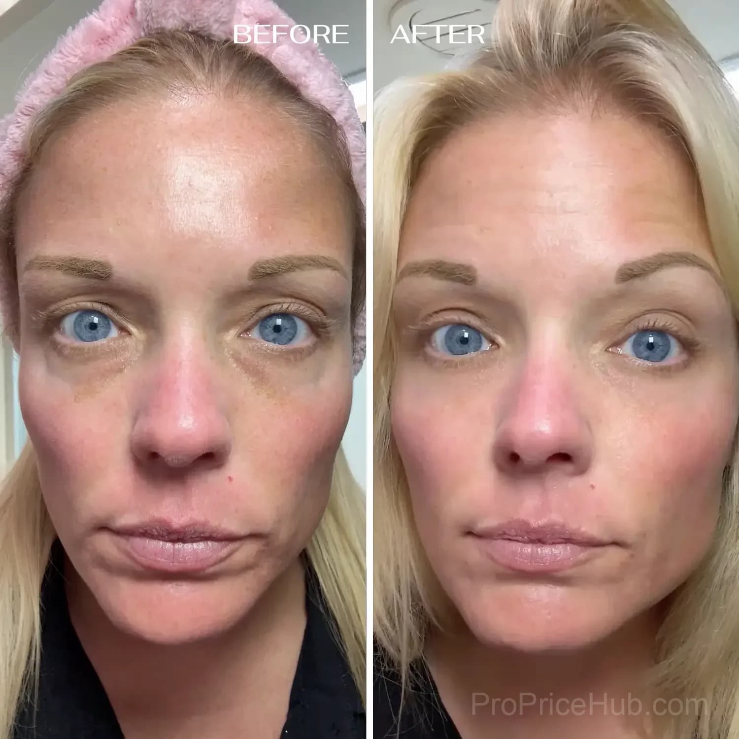 All-in-One Under-Eye Balm - View 7
