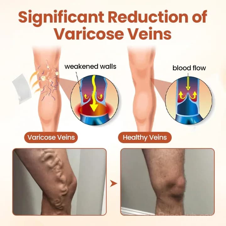 VeinTarget Microneedle Patch - View 3