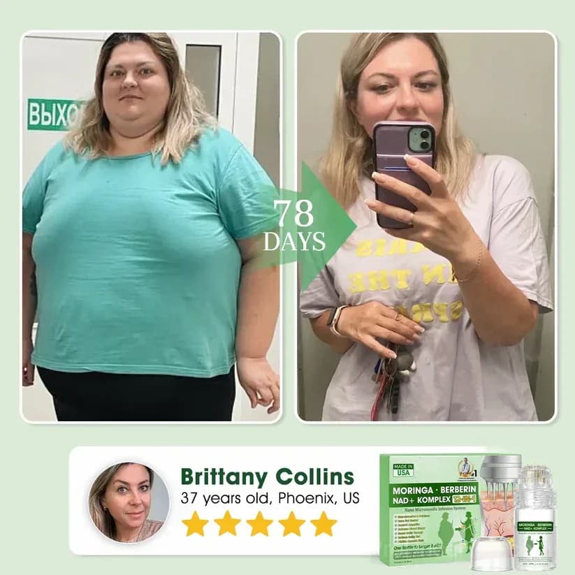 OUR+ Nano Microneedle Infusion System – Moringa, Berberine + NAD+ Metabolic Complex - View 4
