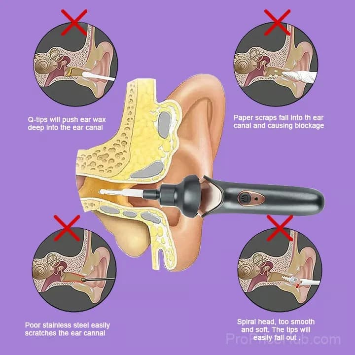 Painless Ear Cleaning Tool for Family, White - View 4